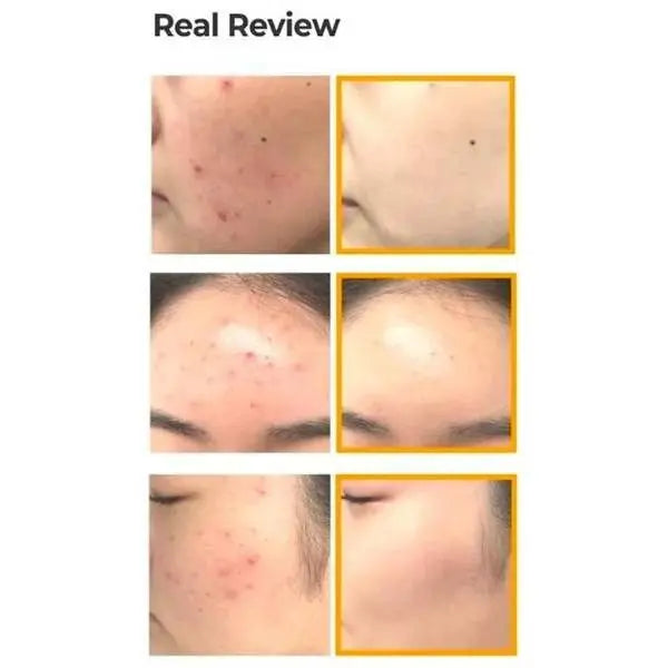 SOMEBYMI Propolis Toner - toner calmant cu propolis, 150ml Some By Mi