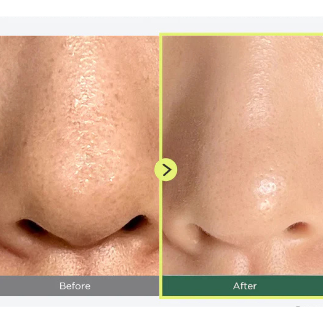 Anua - Heartleaf Pore Control Cleansing Oil (Mini) - Ulei de curățare pentru pori - e-Ko Skin (Image 3)