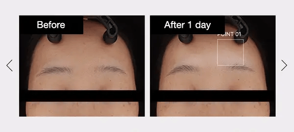 Medicube - Zero Pore Serum - Ser pentru diminuarea porilor - e-Ko Skin (Image 2)