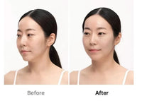 AGE-R ULTRA TUNE 40.68 - Dispozitiv facial profesional pentru bărbie dublă (gușă) - Medicube